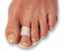 Budin splint