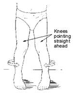 Knees Pointing Straight Ahead