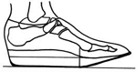 Shoe Modifications