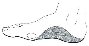 Medial Flange