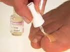 fungal thick nails treatment topical fungal thick nails treatment topical