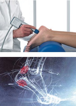 extracorporeal pulse activation