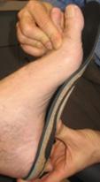 flat feet loose fit orthotic
