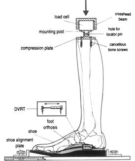 orthotic study