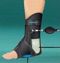Arch support for posterior tibial tendonitis top
