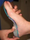 total contact foot orthotics