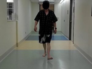 walking gait analysis seattle