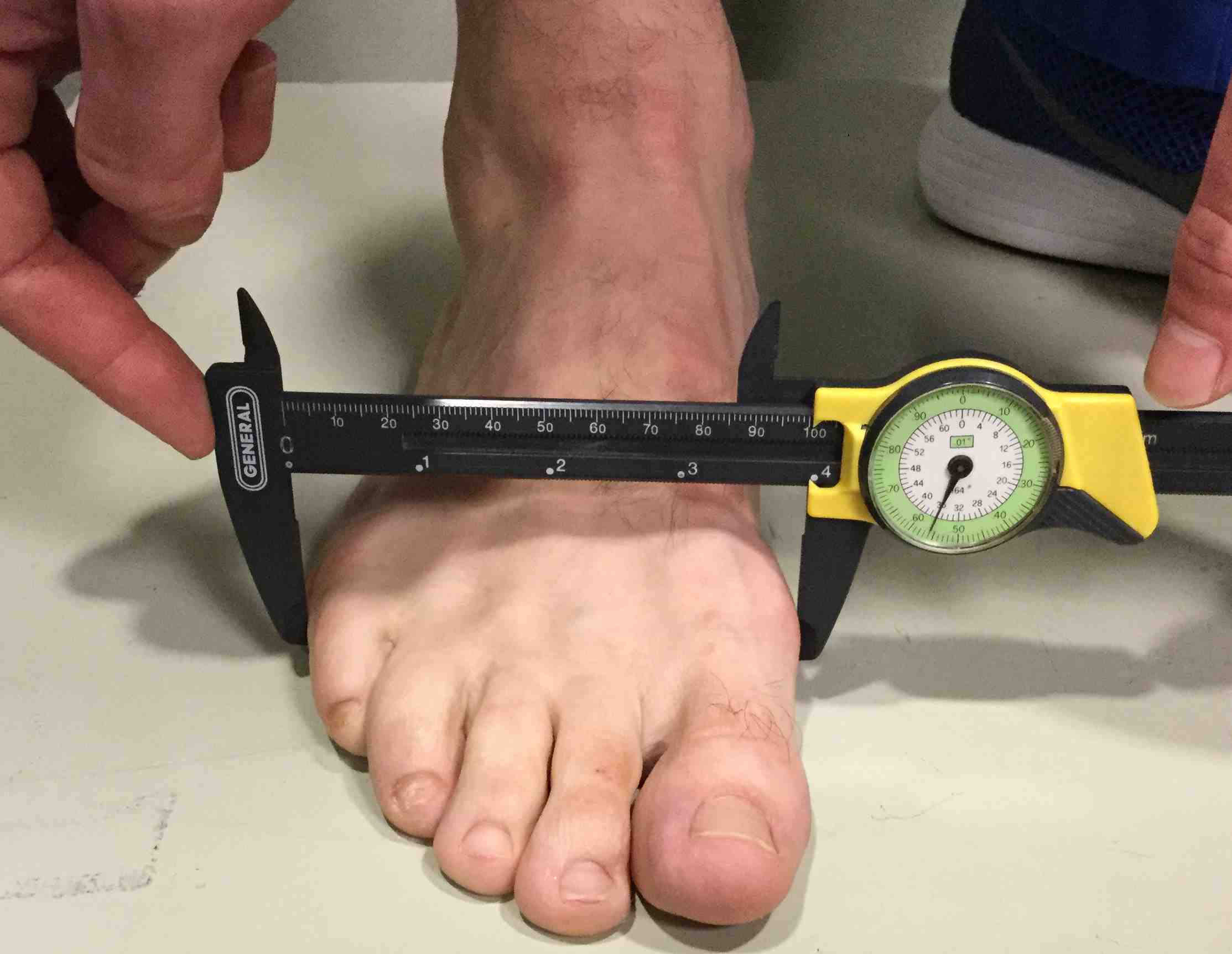 Arch Pain in Skiers Cures and Prevention Seattle Podiatrist