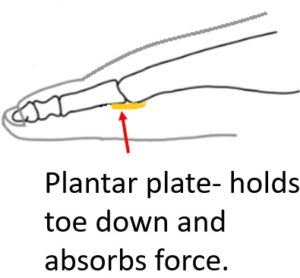 plantar plate intact